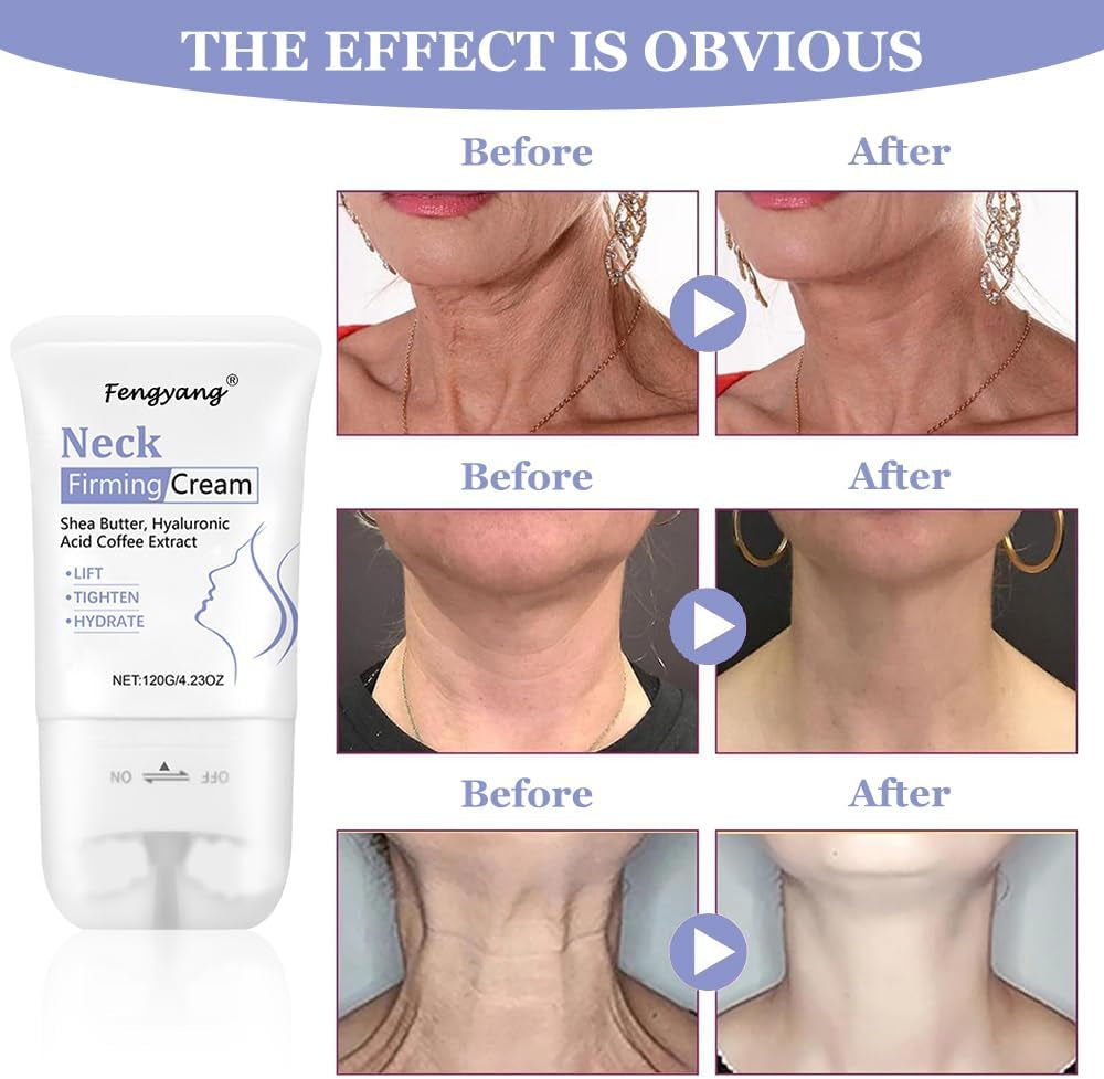 ® Neck Firming Cream,Neck Collagen Cream with Massage Roller – Tightens, Lifts & Smooths Wrinkles for Loose Skin – Anti-Aging Neck Cream for Women