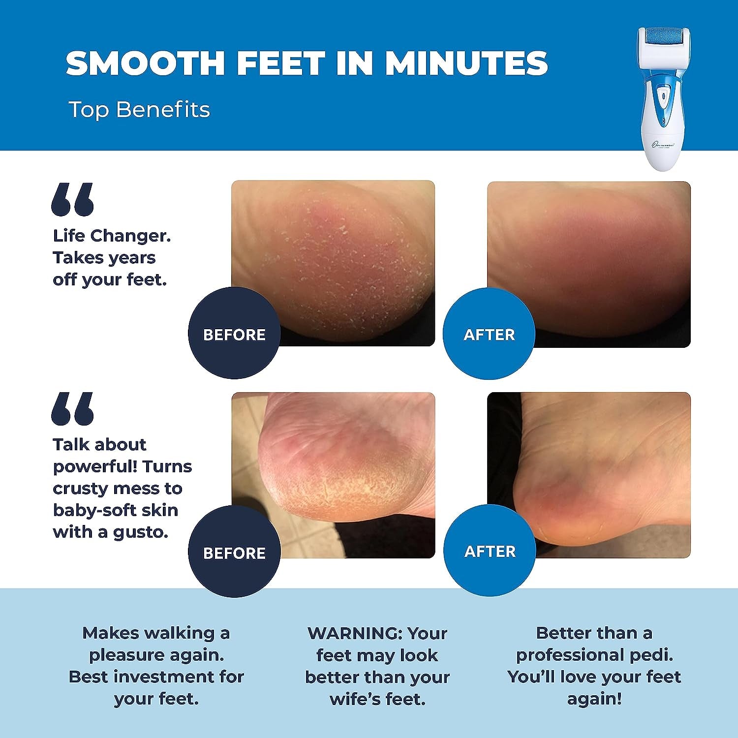 Electric Hard Skin Remover by : Usa'S Best Rated Callus Remover - Rechargeable Pedicure Tools W/ 3 Coarse Diamond Rollers - for Velvet-Smooth Foot Care - Professional (Universal USB Cord)