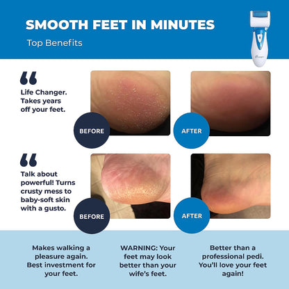 Electric Hard Skin Remover by : Usa'S Best Rated Callus Remover - Rechargeable Pedicure Tools W/ 3 Coarse Diamond Rollers - for Velvet-Smooth Foot Care - Professional (Universal USB Cord)
